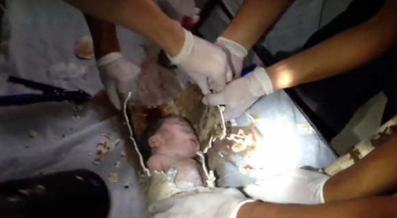 الصين: إنقاذ طفل حديث الولادة من أنابيب الصرف
